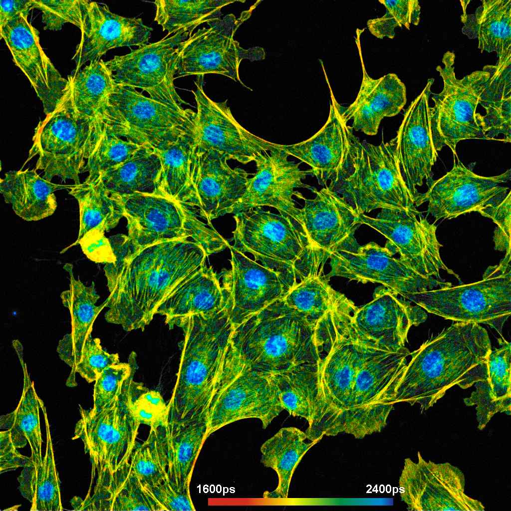 FLIM изображение, полученное с помощью системы Becker&Hickl FLIM изображение, полученное с помощью системы Becker&Hickl
